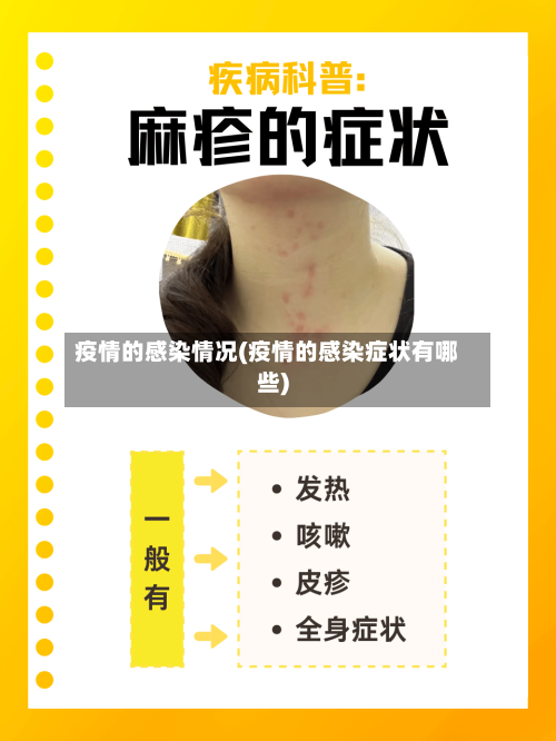 疫情的感染情况(疫情的感染症状有哪些)