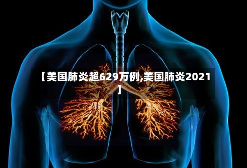 【美国肺炎超629万例,美国肺炎2021】
