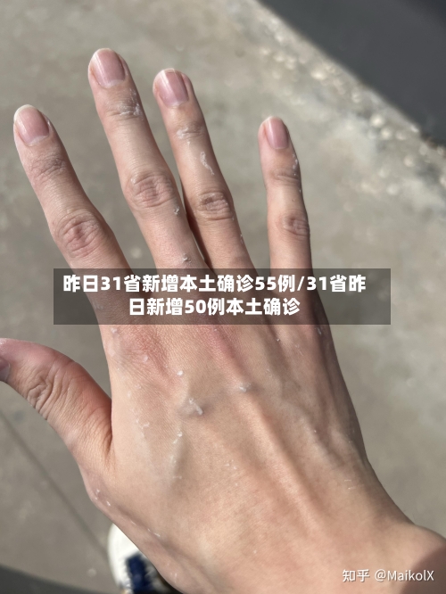 昨日31省新增本土确诊55例/31省昨日新增50例本土确诊-第3张图片