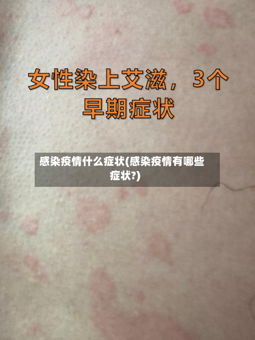 感染疫情什么症状(感染疫情有哪些症状?)-第3张图片