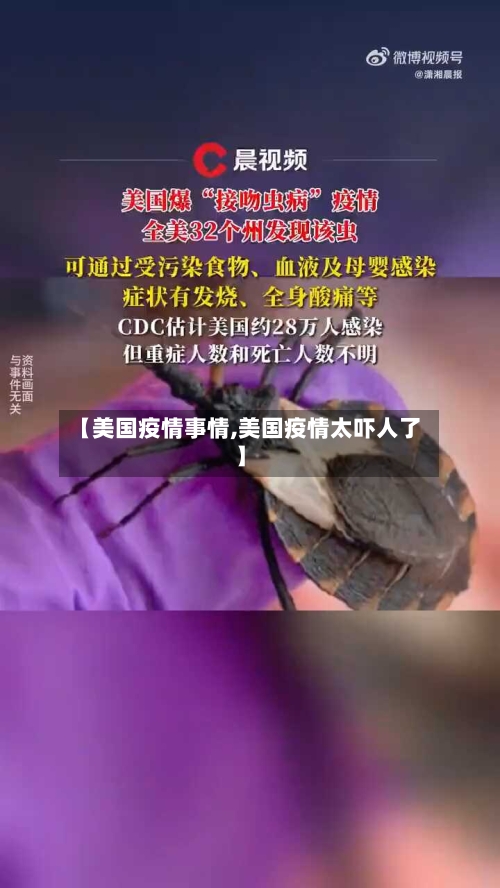 【美国疫情事情,美国疫情太吓人了】