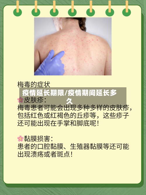 疫情延长期限/疫情期间延长多久