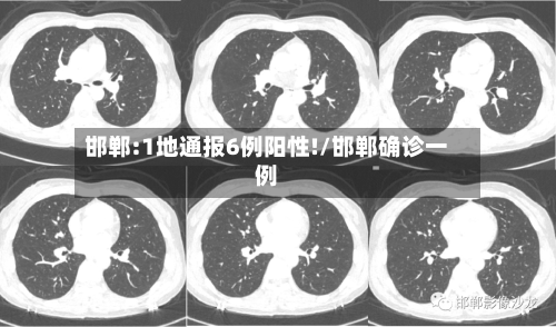 邯郸:1地通报6例阳性!/邯郸确诊一例-第2张图片