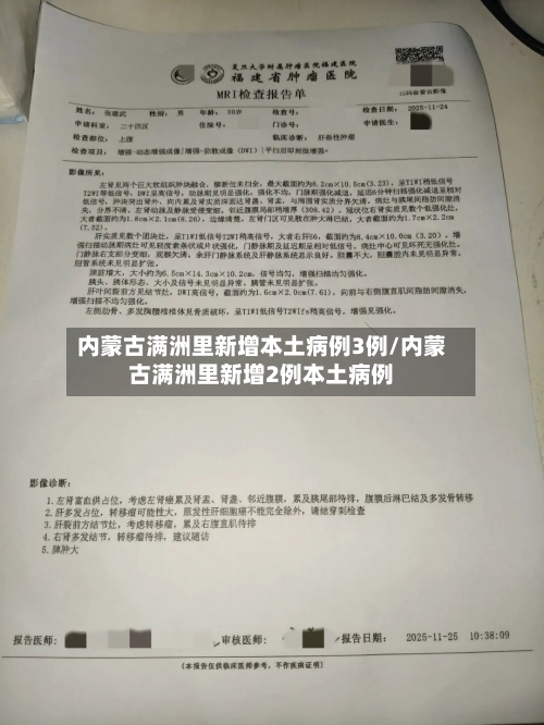 内蒙古满洲里新增本土病例3例/内蒙古满洲里新增2例本土病例