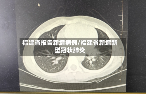 福建省报告新增病例/福建省新增新型冠状肺炎